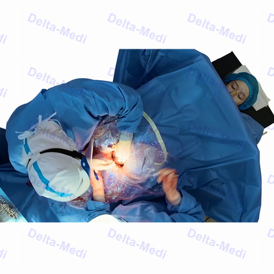 De steriele Chirurgische c-Sectie drapeert met de Gynaecologie van Raamindelingsobsterics drapeert Pak